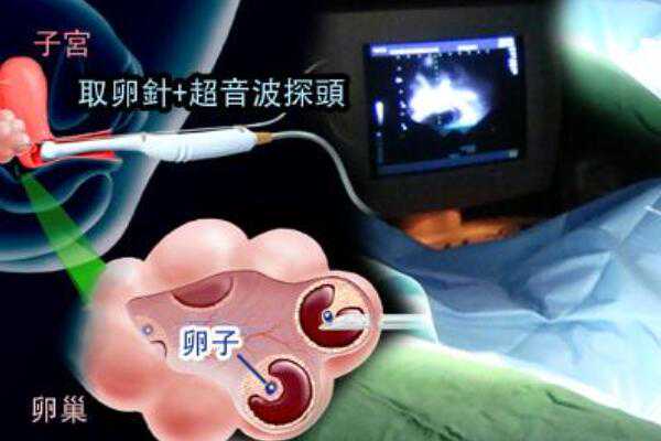 深圳康健妇婴医院做试管婴儿怎么样？,深圳协和医院生殖中心做试管婴儿移植
