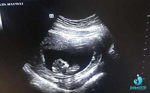 青浦供卵怀孕需要多长时间_试管婴儿最全详细流程_广州女性多囊性卵巢综合症