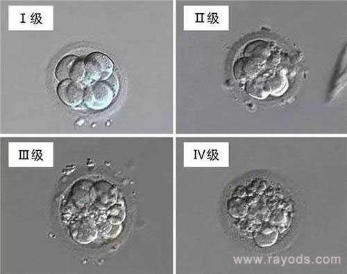 舟山供卵的孩子像老公吗_舟山供卵试管可以做亲子鉴定么_试管胚胎等级分类，