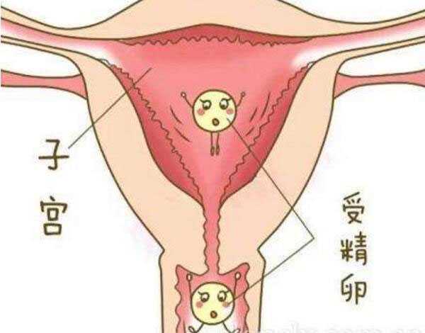 陇南个人代孕qq号_泰国试管婴儿可以科学避免生化妊娠吗?