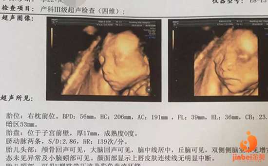 滨州最出名的代孕机构_滨州怎么联系代孕_【国内可以做供卵试管吗】医生说，
