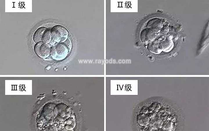 六安代孕公司联系方式_六安代孕中心价格表_二代试管培养的胚胎质量怎么样？
